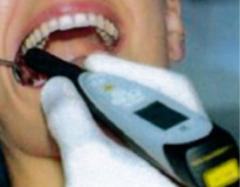 虫歯検知器導入